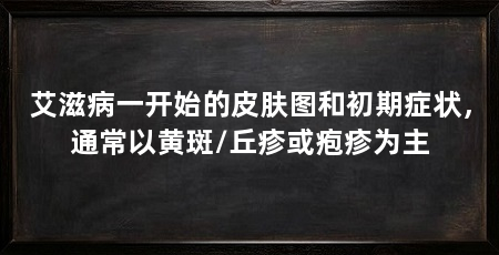 艾滋病一开始的皮肤图和初期症状,通常以黄斑/丘疹或疱疹为主