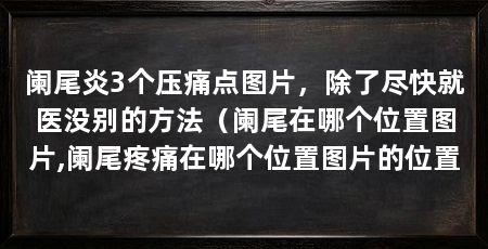 阑尾炎3个压痛点图片，除了尽快就医没别的方法（阑尾在哪个位置图片,阑尾疼痛在哪个位置图片的位置