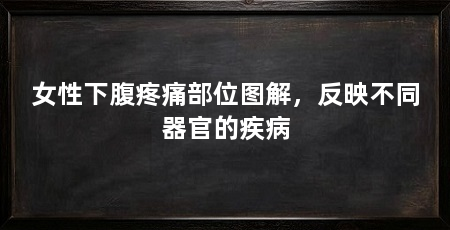 女性下腹疼痛部位图解,反映不同器官的疾病