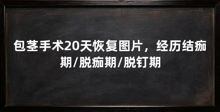 包茎手术20天恢复图片,经历结痂期/脱痂期/脱钉期