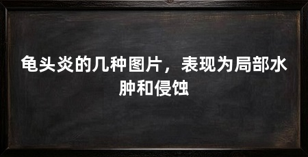 龟头炎的几种图片，表现为局部水肿和侵蚀