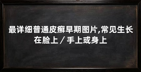 最详细普通皮癣早期图片,常见生长在脸上／手上或身上