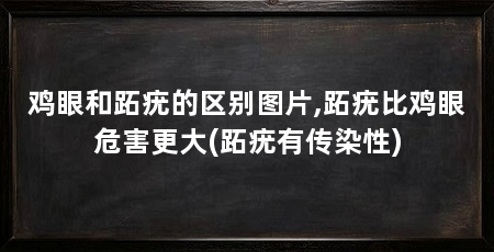 鸡眼和跖疣的区别图片,跖疣比鸡眼危害更大(跖疣有传染性)