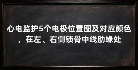 心电监护5个电极位置图及对应颜色，在左、右侧锁骨中线肋缘处