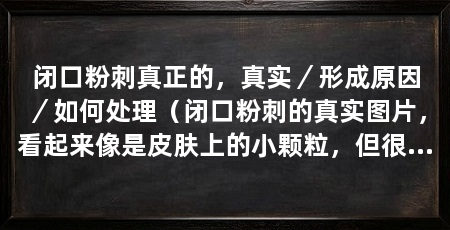 闭口粉刺真正的，真实／形成原因／如何处理（闭口粉刺的真实图片，看起来像是皮肤上的小颗粒，但很难挤出