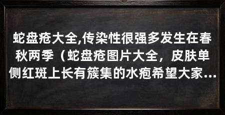 蛇盘疮大全,传染性很强多发生在春秋两季（蛇盘疮图片大全，皮肤单侧红斑上长有簇集的水疱希望大家能找到答案