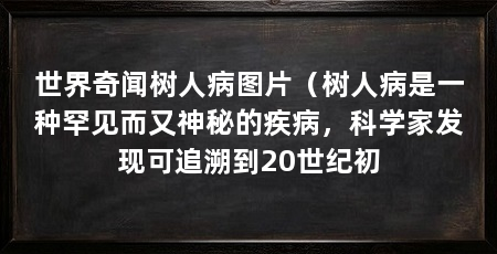 世界奇闻树人病图片（树人病是一种罕见而又神秘的疾病，科学家发现可追溯到20世纪初