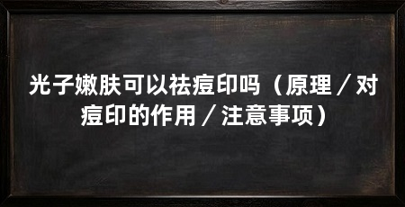 光子嫩肤可以祛痘印吗(原理/对痘印的作用/注意事项)