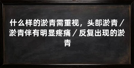 什么样的淤青需重视，头部淤青／淤青伴有明显疼痛／反复出现的淤青