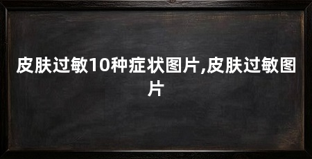 皮肤过敏10种症状图片,皮肤过敏图片