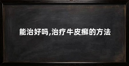 能治好吗,治疗牛皮癣的方法