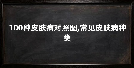 100种皮肤病对照图,常见皮肤病种类