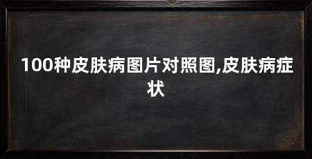 100种皮肤病图片对照图,皮肤病症状