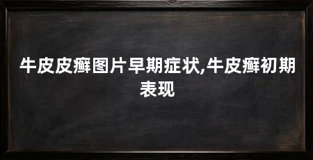 牛皮皮癣图片早期症状,牛皮癣初期表现