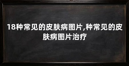 18种常见的皮肤病图片,种常见的皮肤病图片治疗