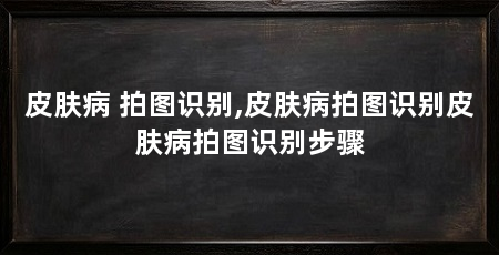 皮肤病 拍图识别,皮肤病拍图识别皮肤病拍图识别步骤