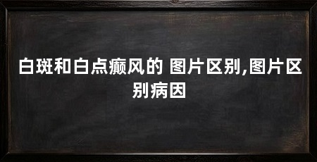 白斑和白点癫风的 图片区别,图片区别病因