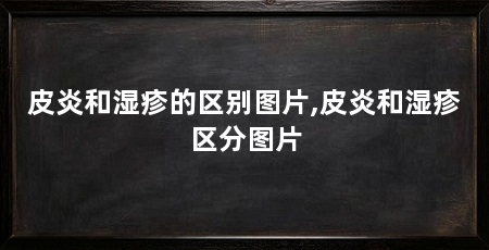 皮炎和湿疹的区别图片,皮炎和湿疹区分图片