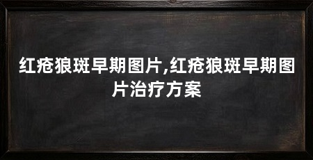 红疮狼斑早期图片,红疮狼斑早期图片治疗方案