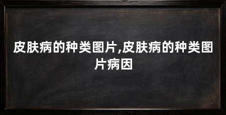 皮肤病的种类图片,皮肤病的种类图片病因